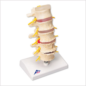 椎间盘脱垂及脊椎退行性变模型A795